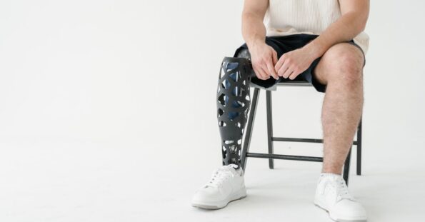 Semelle 3d : comment choisir sans se tromper ? - Ortho nice