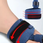 Orthèse hallux valgus pour fracture des orteils avec barre réglable en aluminium