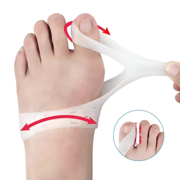 Orthèse hallux Valgus en Silicone, chevauchement des gros orteils