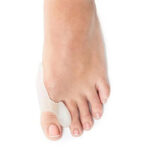 Attelle Orthopédiques Correctrice Hallux Valgus - Ortho-feet
