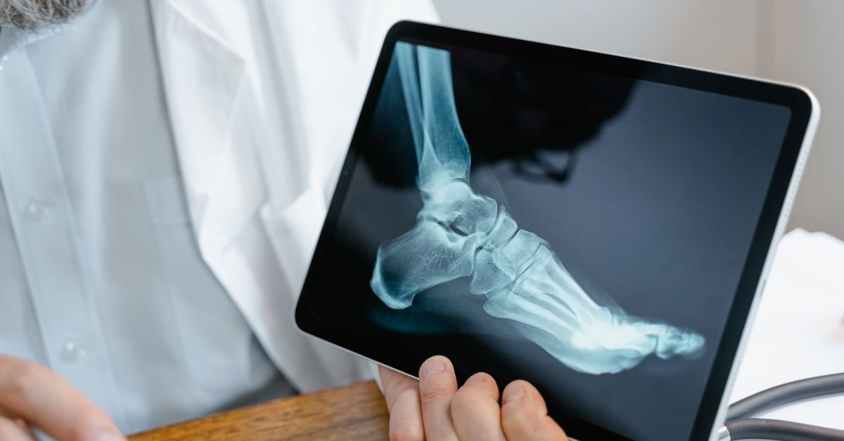 A doctor examines an x-ray image of a foot displayed on a tablet.